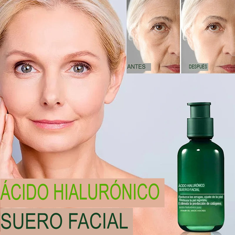 serum-rejuvenecedor-con-acido-hialuronico-eelhoe-para-arrugas-hidratacion-firmeza-y-elasticidad-80-ml-utily-tienda