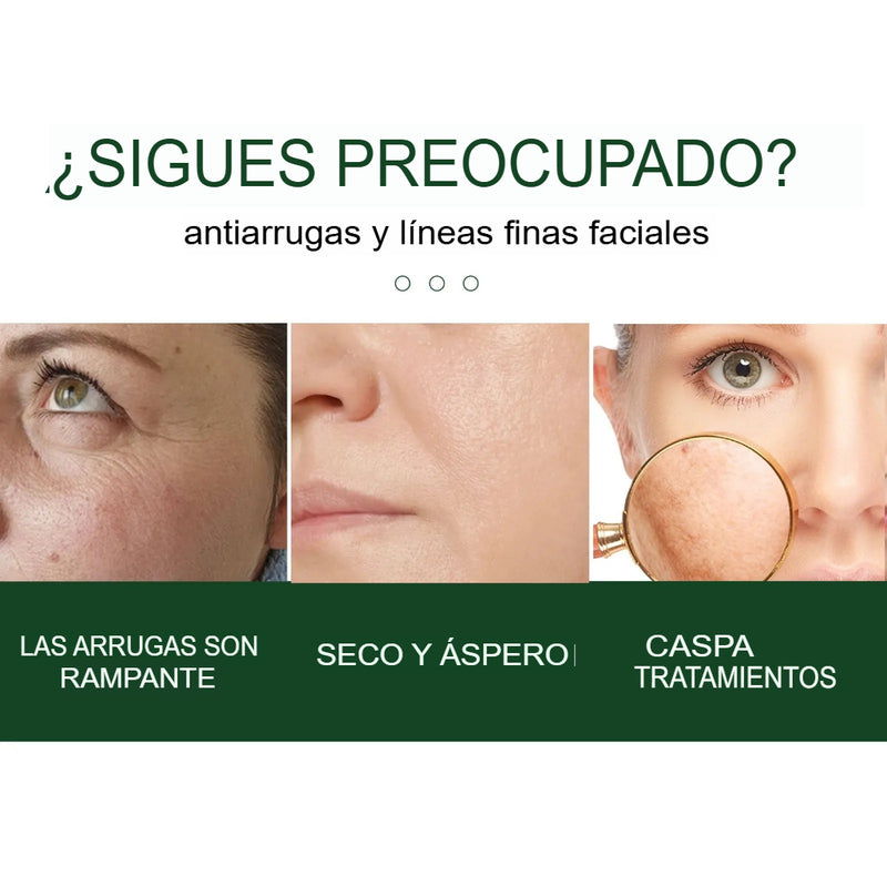 serum-rejuvenecedor-con-acido-hialuronico-eelhoe-para-arrugas-hidratacion-firmeza-y-elasticidad-80-ml-utily-tienda