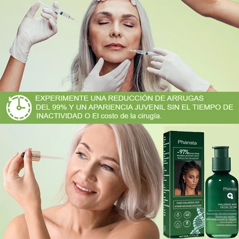 serum-rejuvenecedor-con-acido-hialuronico-eelhoe-para-arrugas-hidratacion-firmeza-y-elasticidad-80-ml-utily-tienda