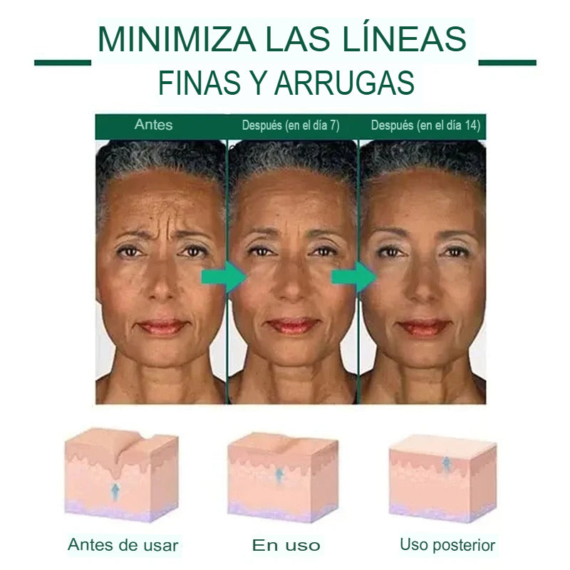 serum-rejuvenecedor-con-acido-hialuronico-eelhoe-para-arrugas-hidratacion-firmeza-y-elasticidad-80-ml-utily-tienda